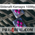 Sildenafil Kamagra 100Mg 01